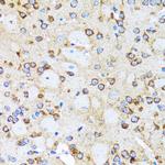 Arp2 Antibody in Immunohistochemistry (Paraffin) (IHC (P))