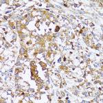 Arp2 Antibody in Immunohistochemistry (Paraffin) (IHC (P))