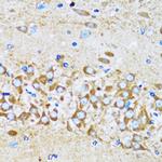 Arp2 Antibody in Immunohistochemistry (Paraffin) (IHC (P))