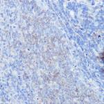 IFNGR1 Antibody in Immunohistochemistry (Paraffin) (IHC (P))