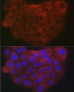 COL1A2 Antibody in Immunocytochemistry (ICC/IF)