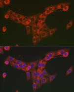 COL1A2 Antibody in Immunocytochemistry (ICC/IF)