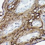 COL1A2 Antibody in Immunohistochemistry (Paraffin) (IHC (P))