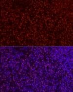 SATB1 Antibody in Immunocytochemistry (ICC/IF)