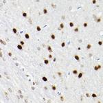 SATB1 Antibody in Immunohistochemistry (Paraffin) (IHC (P))