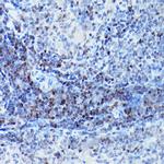 SATB1 Antibody in Immunohistochemistry (Paraffin) (IHC (P))