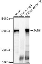 SATB1 Antibody in Immunoprecipitation (IP)