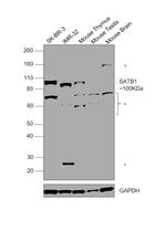 SATB1 Antibody in Western Blot (WB)