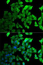 Septin 2 Antibody in Immunocytochemistry (ICC/IF)