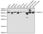 Septin 2 Antibody in Western Blot (WB)