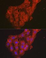 CXCL1 Antibody in Immunocytochemistry (ICC/IF)