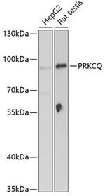 PKC theta Antibody in Western Blot (WB)