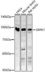 SRPK1 Antibody in Western Blot (WB)