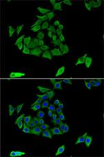 TGM3 Antibody in Immunocytochemistry (ICC/IF)