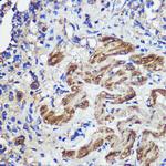 SND1 Antibody in Immunohistochemistry (Paraffin) (IHC (P))