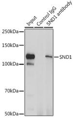 SND1 Antibody in Immunoprecipitation (IP)