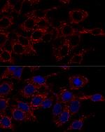 ATP5A1 Antibody in Immunocytochemistry (ICC/IF)