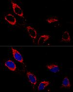 ATP5A1 Antibody in Immunocytochemistry (ICC/IF)