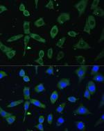 eIF3d Antibody in Immunocytochemistry (ICC/IF)