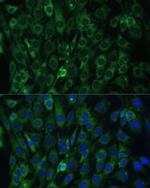 eIF3d Antibody in Immunocytochemistry (ICC/IF)