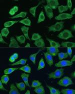 eIF3d Antibody in Immunocytochemistry (ICC/IF)