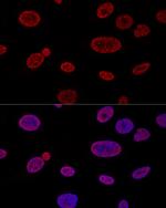 ALY Antibody in Immunocytochemistry (ICC/IF)