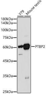 PTBP2 Antibody in Western Blot (WB)