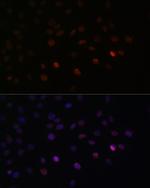 SRSF3 Antibody in Immunocytochemistry (ICC/IF)