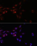 SRSF3 Antibody in Immunocytochemistry (ICC/IF)