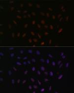 SRSF3 Antibody in Immunocytochemistry (ICC/IF)