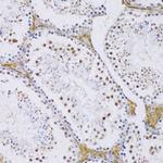 SRSF3 Antibody in Immunohistochemistry (Paraffin) (IHC (P))