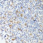 TIAL1 Antibody in Immunohistochemistry (Paraffin) (IHC (P))