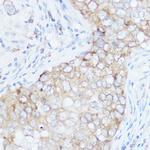 eIF4G Antibody in Immunohistochemistry (Paraffin) (IHC (P))