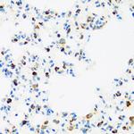 FMRP Antibody in Immunohistochemistry (Paraffin) (IHC (P))