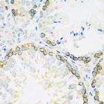 FMRP Antibody in Immunohistochemistry (Paraffin) (IHC (P))