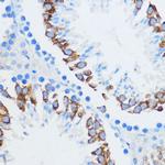 IGF2BP3 Antibody in Immunohistochemistry (Paraffin) (IHC (P))