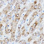 IGF2BP3 Antibody in Immunohistochemistry (Paraffin) (IHC (P))