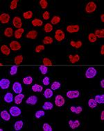 SAM68 Antibody in Immunocytochemistry (ICC/IF)