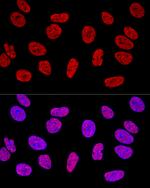 SAM68 Antibody in Immunocytochemistry (ICC/IF)