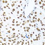 SAM68 Antibody in Immunohistochemistry (Paraffin) (IHC (P))