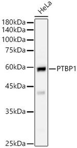 PTBP1 Antibody in Western Blot (WB)