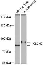 CLCN2 Antibody in Western Blot (WB)