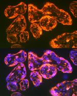 CD49e (Integrin alpha 5) Antibody in Immunohistochemistry (Paraffin) (IHC (P))