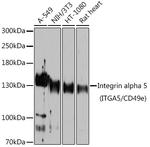 CD49e (Integrin alpha 5) Antibody in Western Blot (WB)