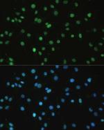 SET Antibody in Immunocytochemistry (ICC/IF)