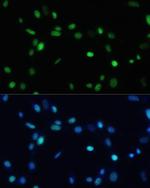 SET Antibody in Immunocytochemistry (ICC/IF)