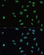 SET Antibody in Immunocytochemistry (ICC/IF)