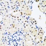 SET Antibody in Immunohistochemistry (Paraffin) (IHC (P))