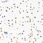 SET Antibody in Immunohistochemistry (Paraffin) (IHC (P))