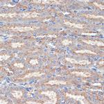 Flotillin 1 Antibody in Immunohistochemistry (Paraffin) (IHC (P))